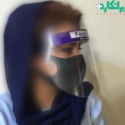شیلد محافظ صورت ثابت